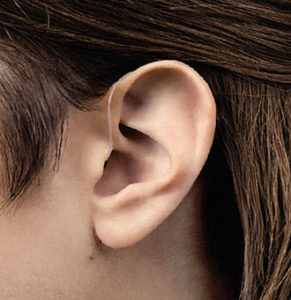 Oreille avec un appareil auditif contour d’oreille
